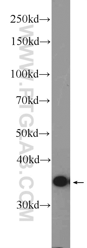 WB analysis of L02 using 25510-1-AP