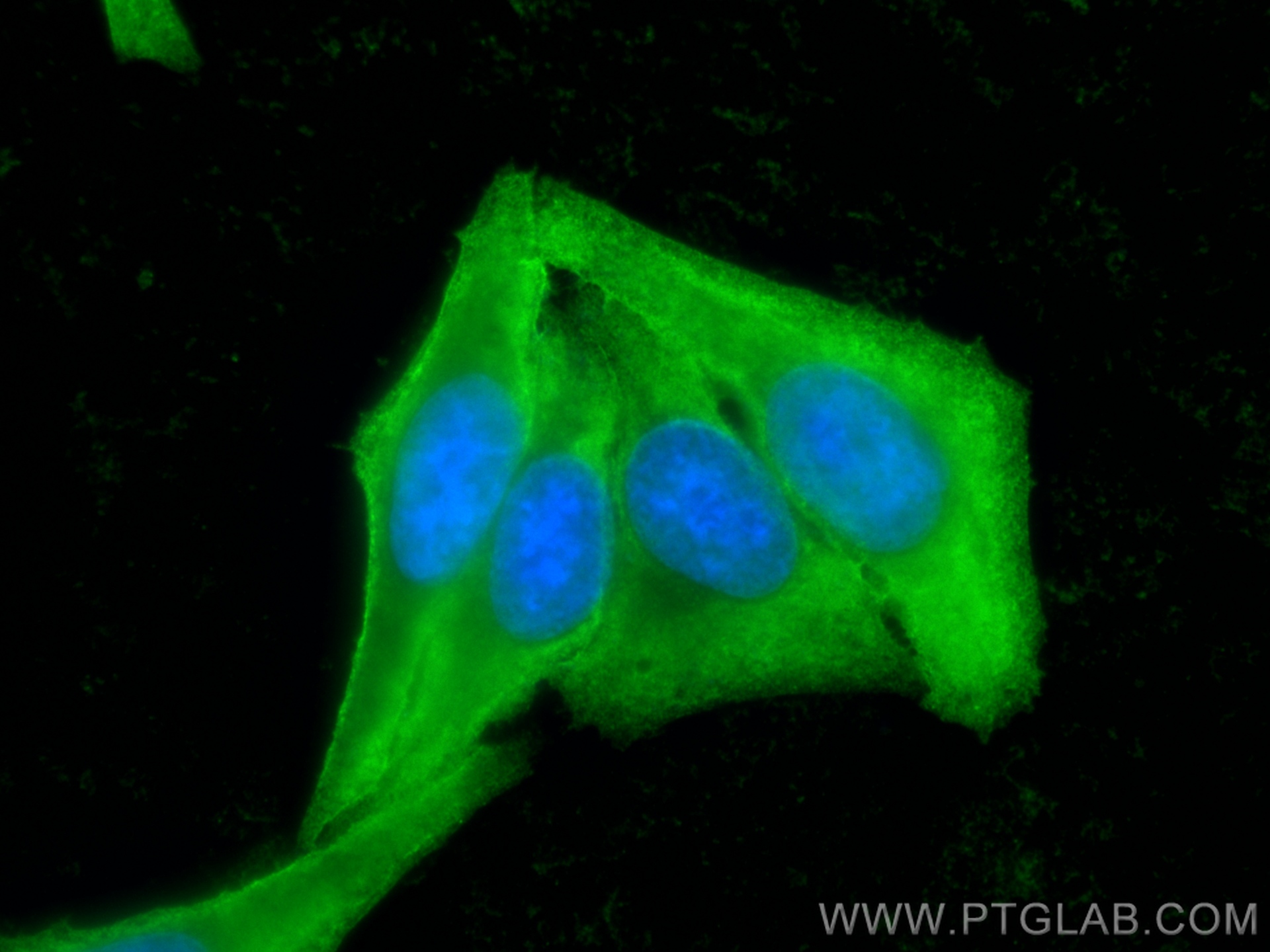 IF Staining of HepG2 using 66634-1-Ig