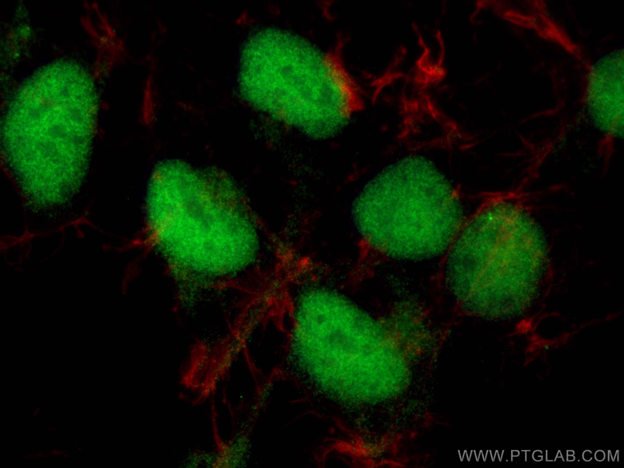 IF Staining of HEK-293 using 24319-1-AP