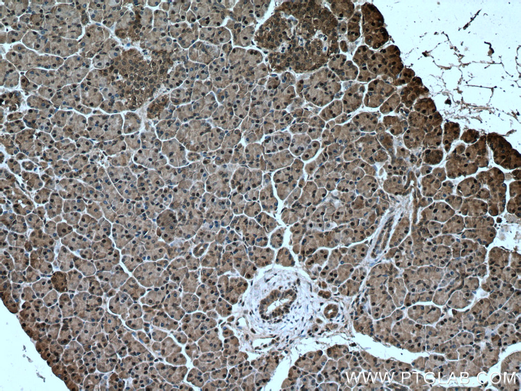 IHC staining of human pancreas using 24319-1-AP