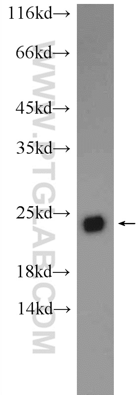 WB analysis of HEK-293 using 24319-1-AP