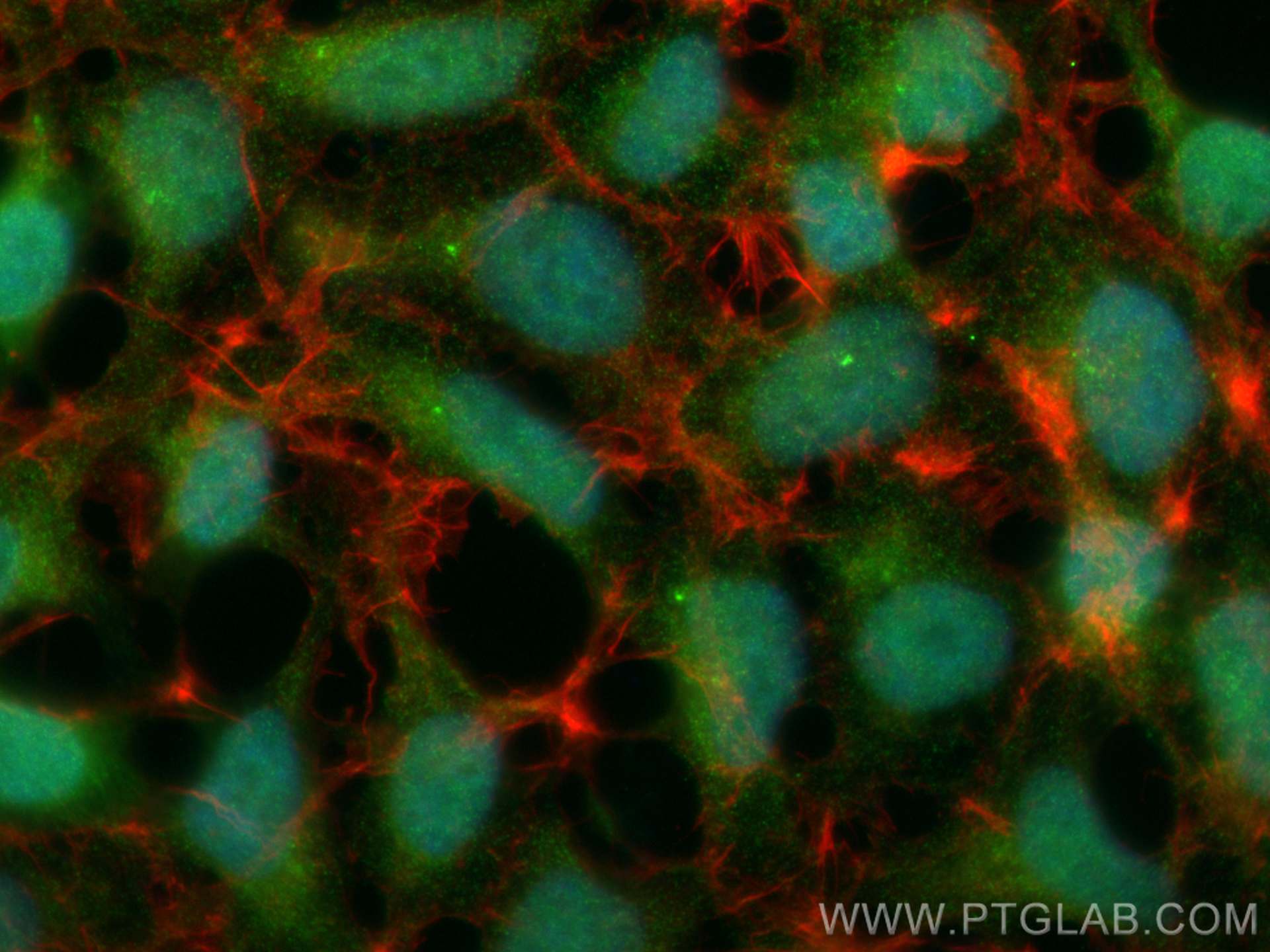 IF Staining of HEK-293 using 68310-1-Ig (same clone as 68310-1-PBS)