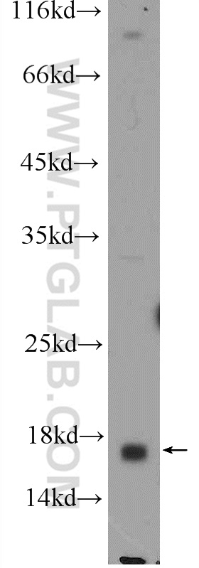 WB analysis of PC-3 using 25249-1-AP