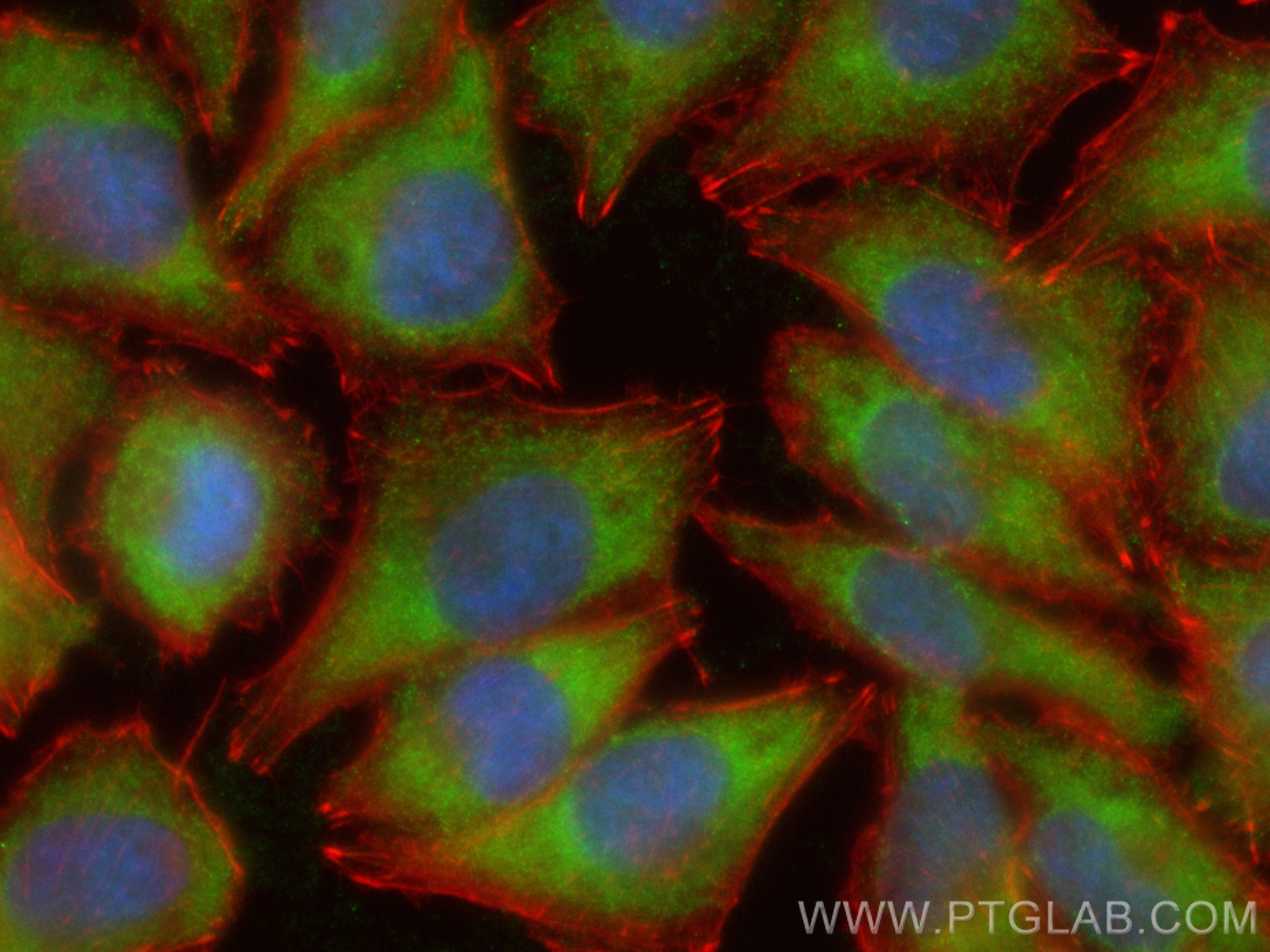 IF Staining of A375 using CL488-24953