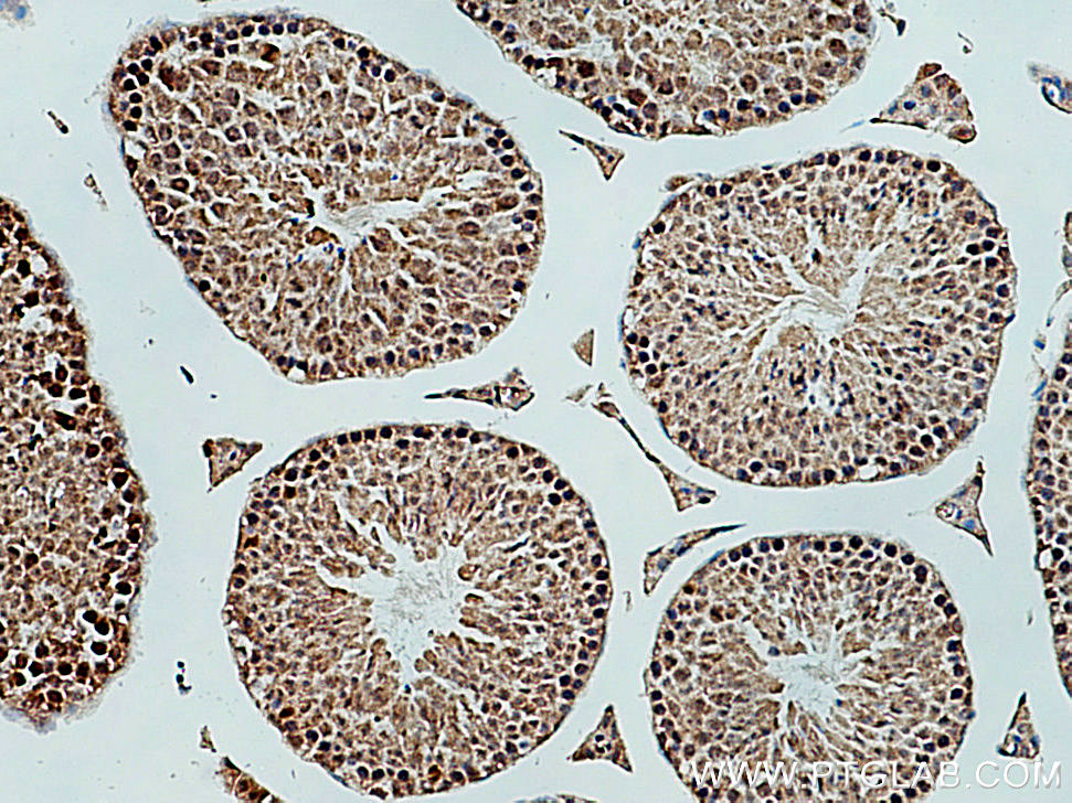 IHC staining of mouse testis using 24588-1-AP