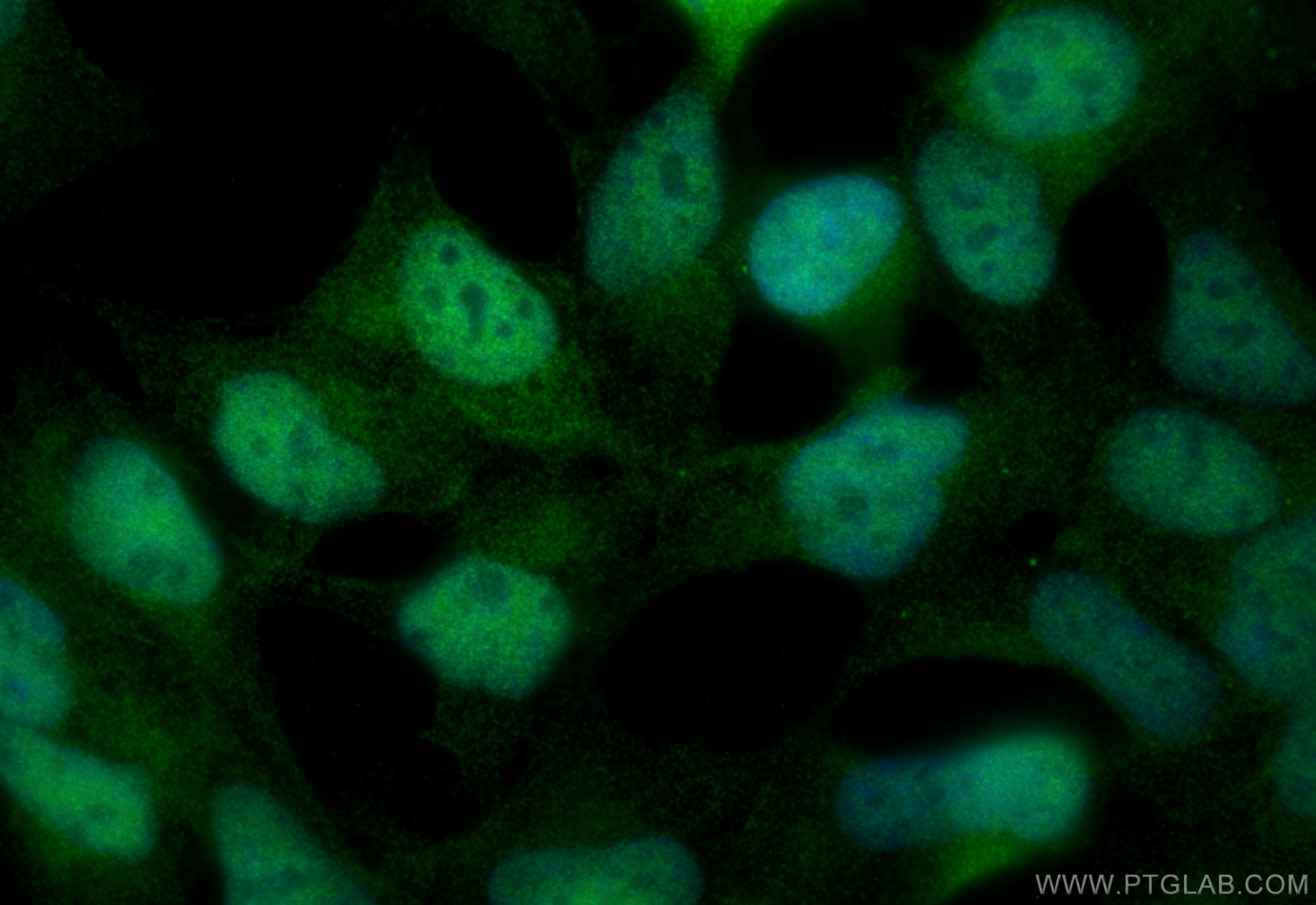 IF Staining of HEK-293 using 31921-1-AP