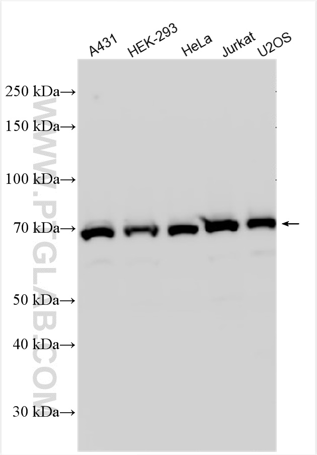 WB analysis using 31921-1-AP