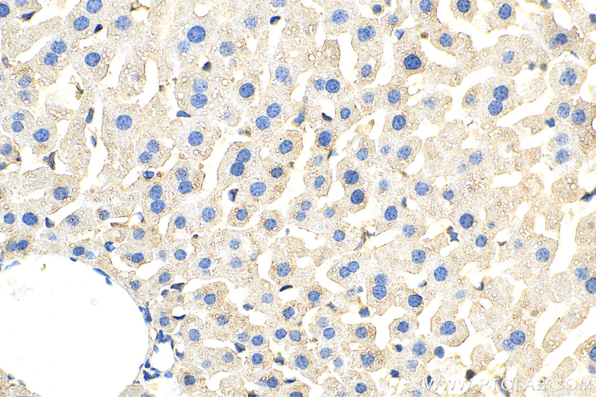 IHC staining of mouse liver using 22159-1-AP (same clone as 22159-1-PBS)