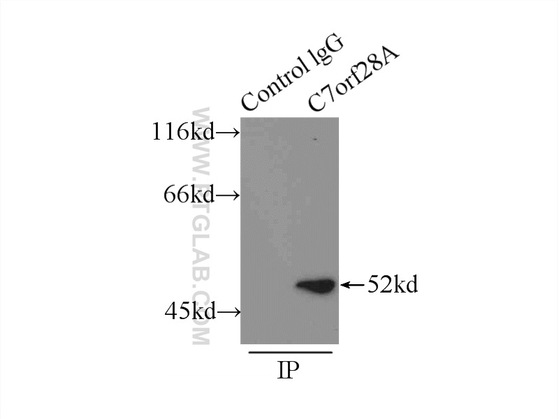 IP experiment of NIH/3T3 using 22159-1-AP (same clone as 22159-1-PBS)