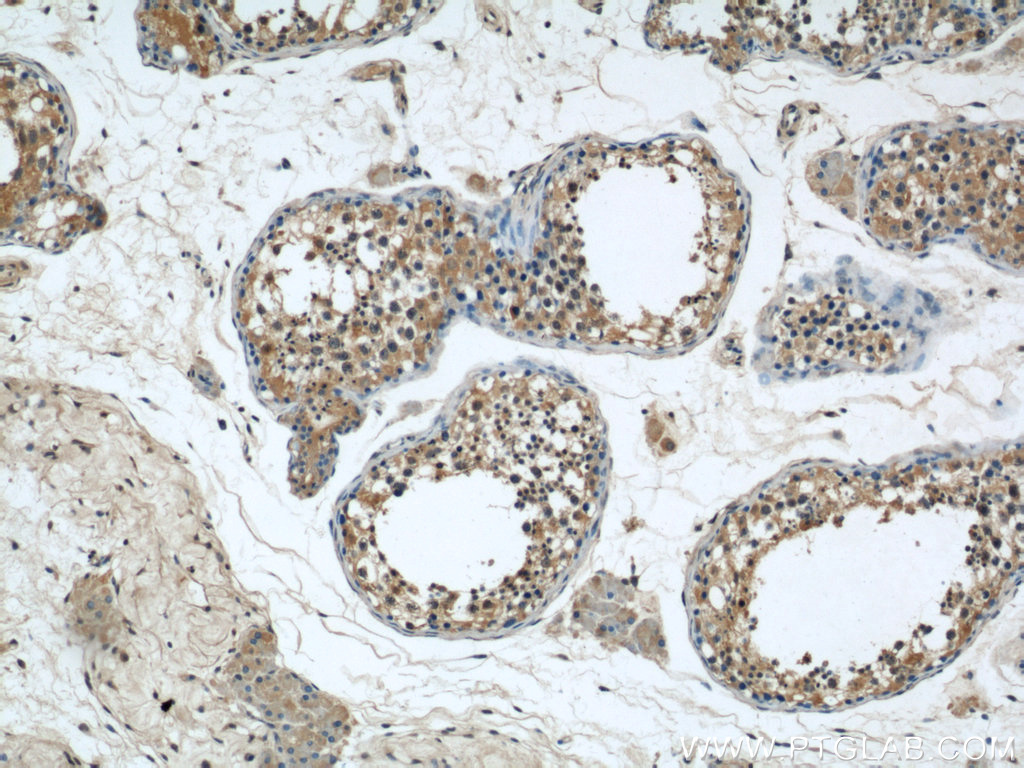 IHC staining of human testis using 22838-1-AP