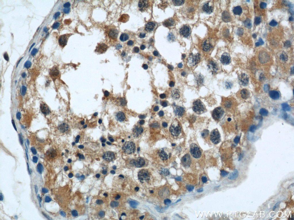 IHC staining of human testis using 22838-1-AP