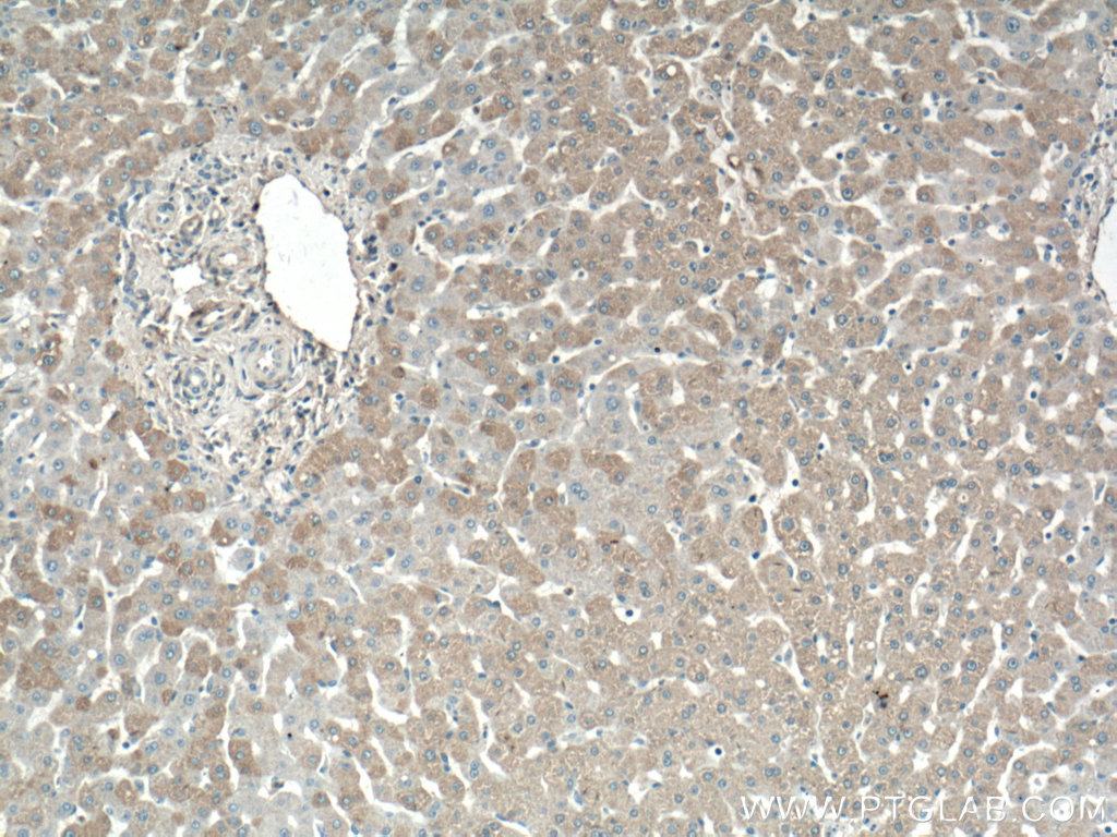 IHC staining of human liver using 27790-1-AP