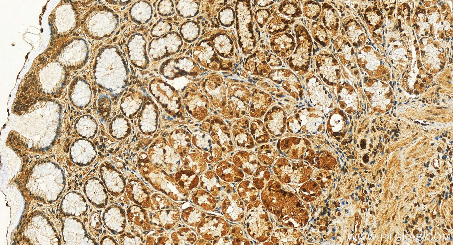 IHC staining of human stomach using 20797-1-AP