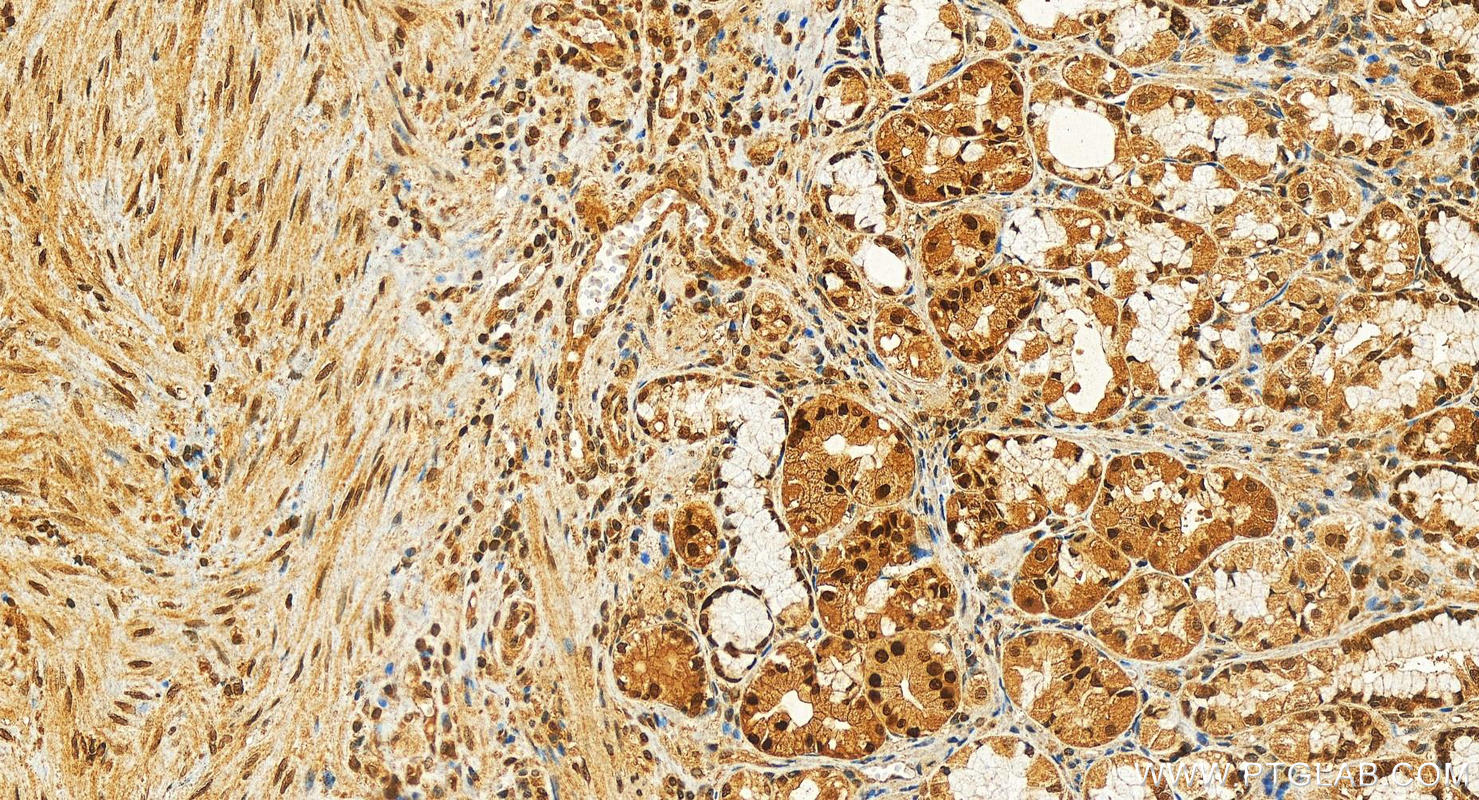 IHC staining of human stomach using 20797-1-AP