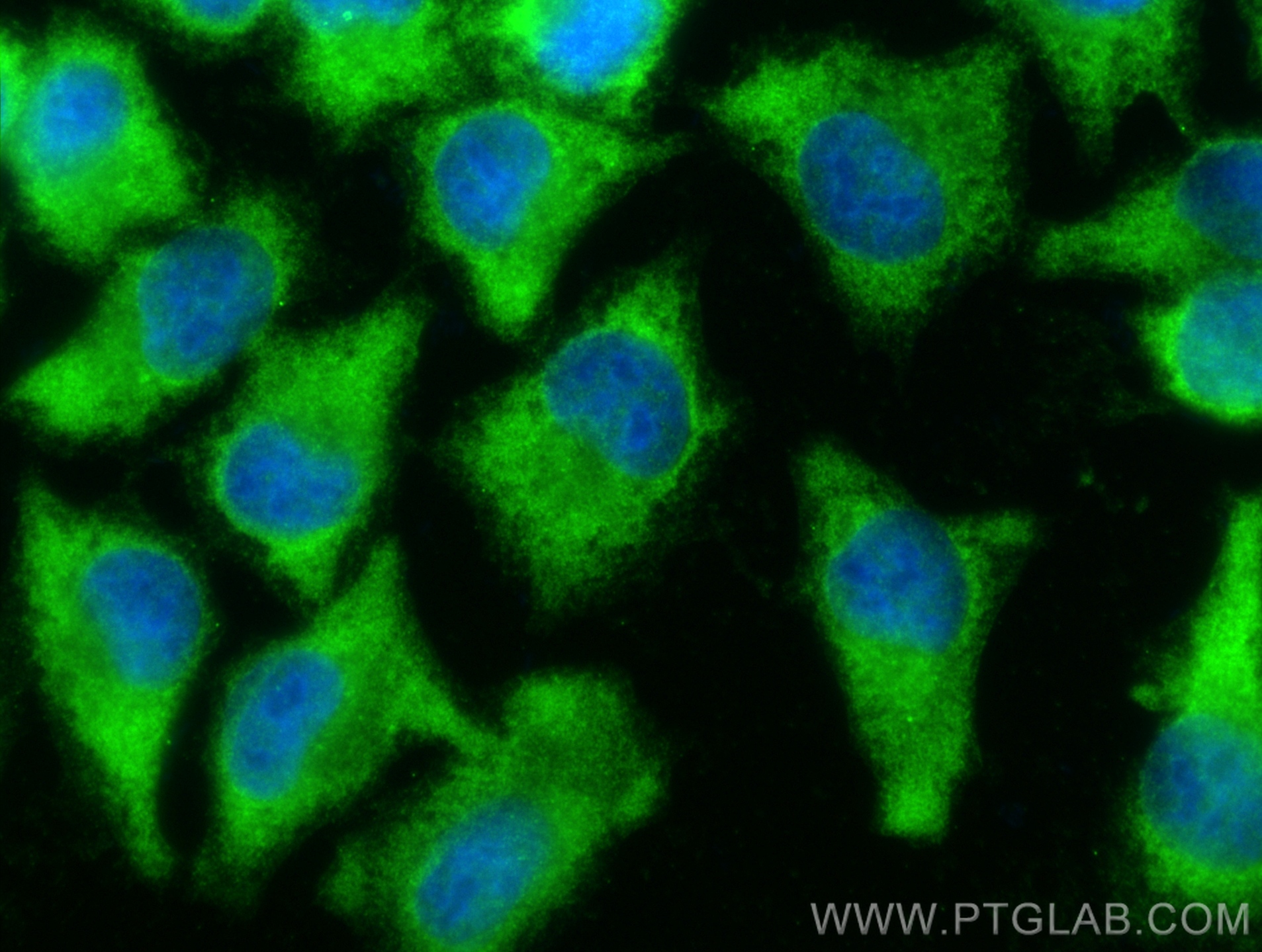 IF Staining of A375 using 20924-1-AP