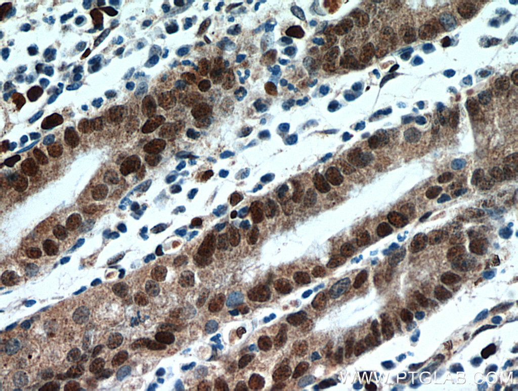 IHC staining of human stomach using 20924-1-AP