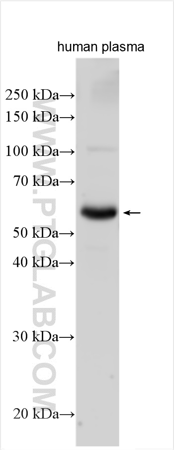 WB analysis of human plasma using 25891-1-AP (same clone as 25891-1-PBS)