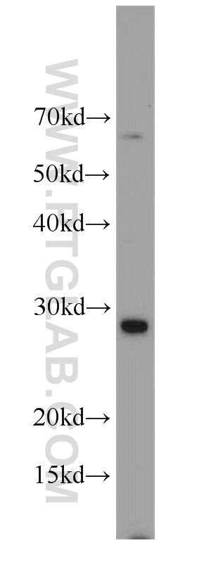 WB analysis of HepG2 using 23168-1-AP