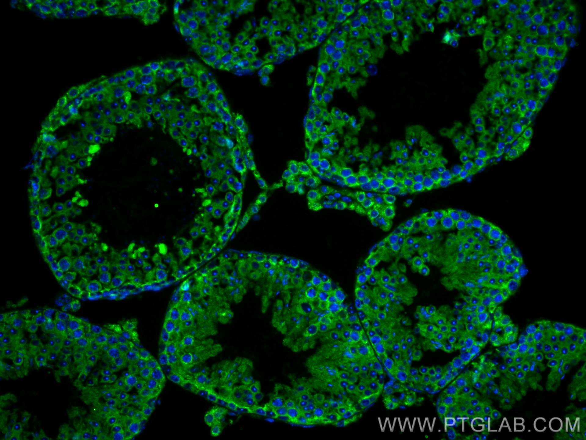 IF Staining of mouse testis using 26576-1-AP