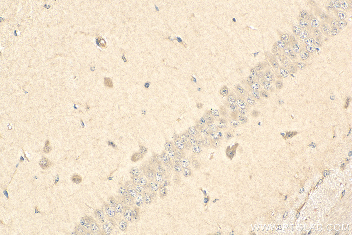 IHC staining of mouse brain using 21012-1-AP