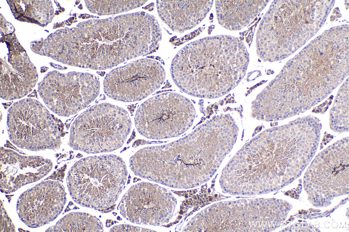 IHC staining of mouse testis using 21593-1-AP