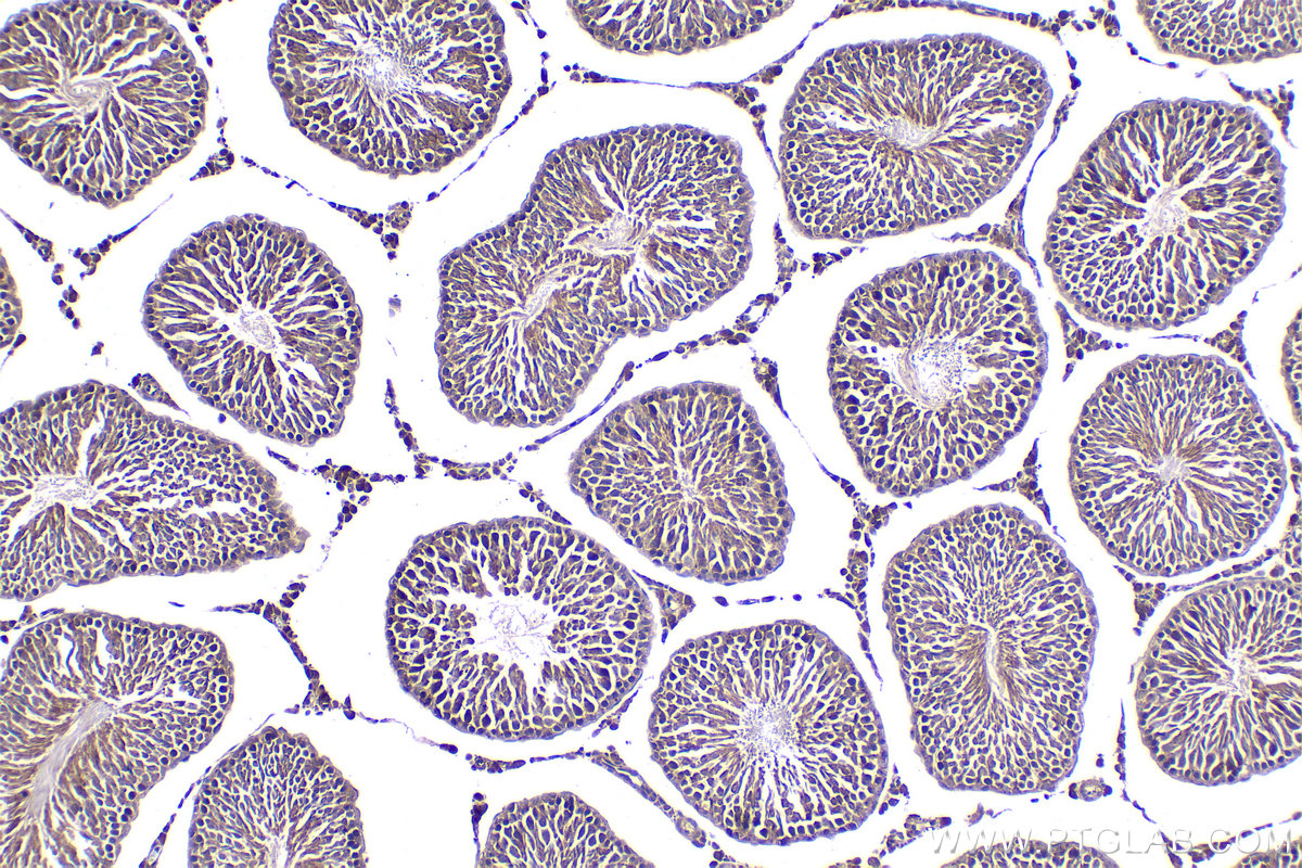 IHC staining of rat testis using 21593-1-AP