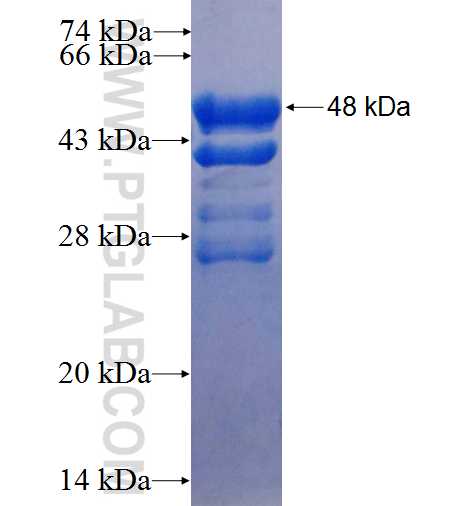 C9orf142 fusion protein Ag24910 SDS-PAGE