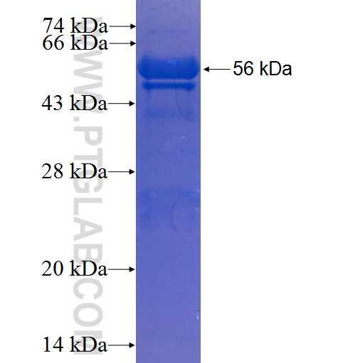 C9orf24 fusion protein Ag23621 SDS-PAGE