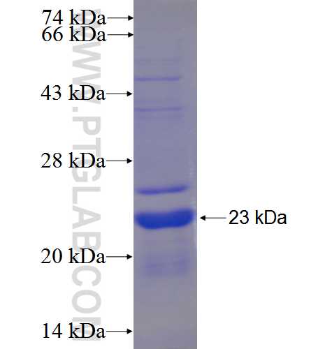 C9orf25 fusion protein Ag23779 SDS-PAGE