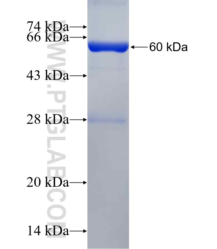 C9orf64 fusion protein Ag23031 SDS-PAGE