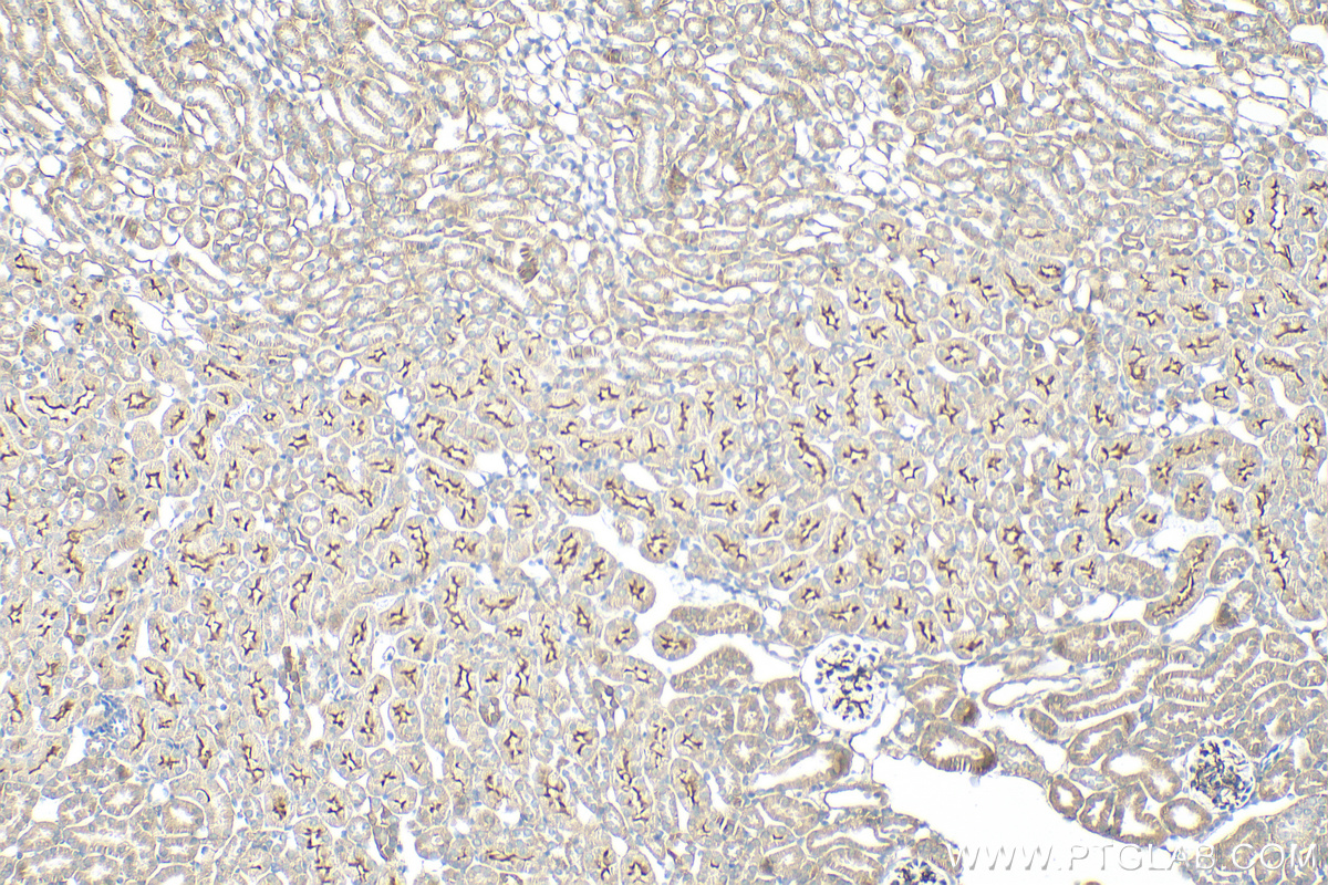 IHC staining of mouse kidney using 30509-1-AP