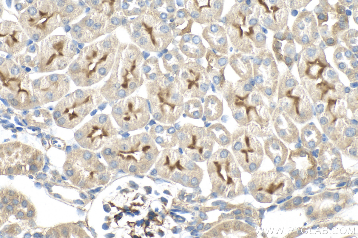 IHC staining of mouse kidney using 30509-1-AP