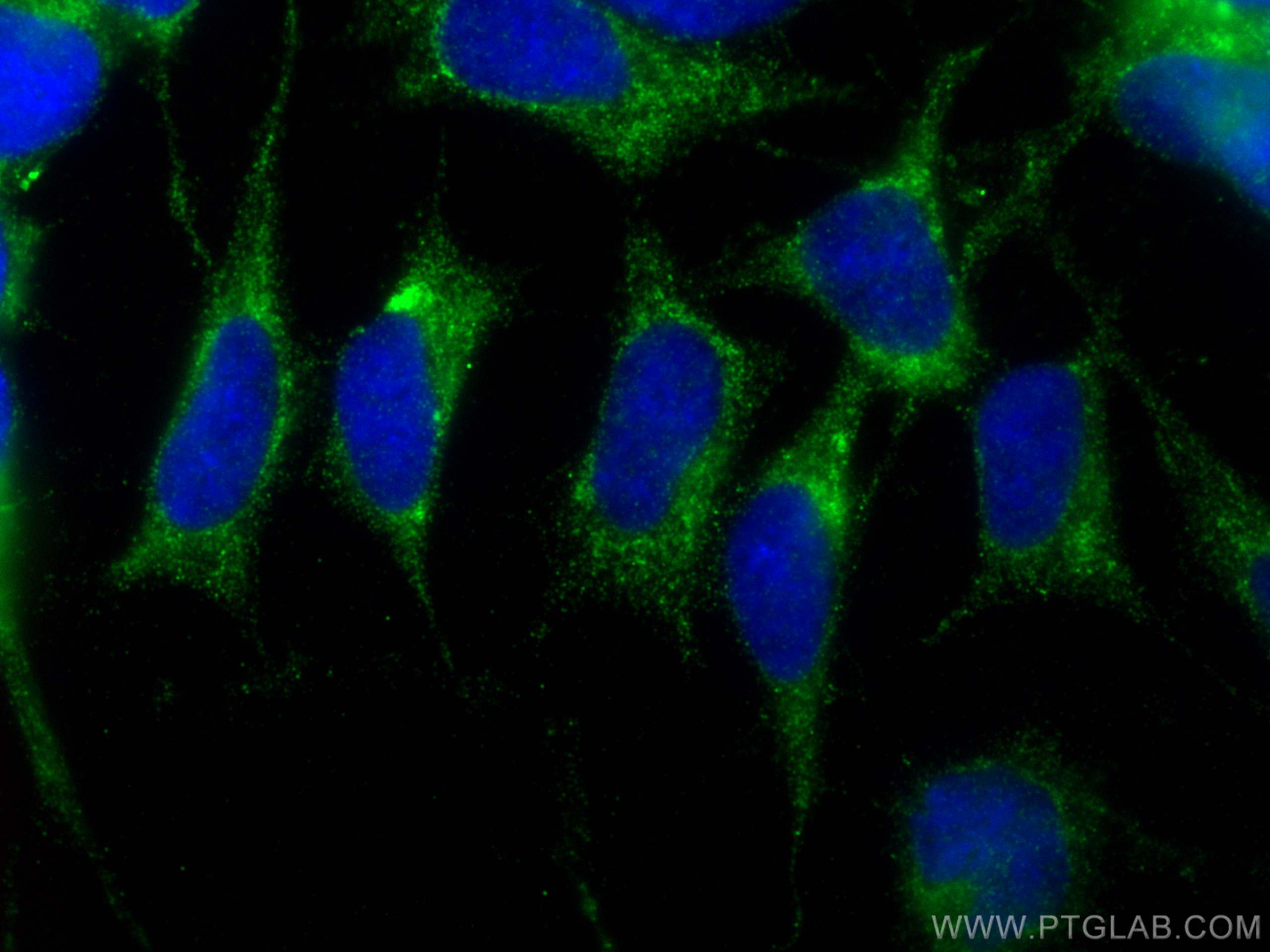 IF Staining of SH-SY5Y using 22637-1-AP