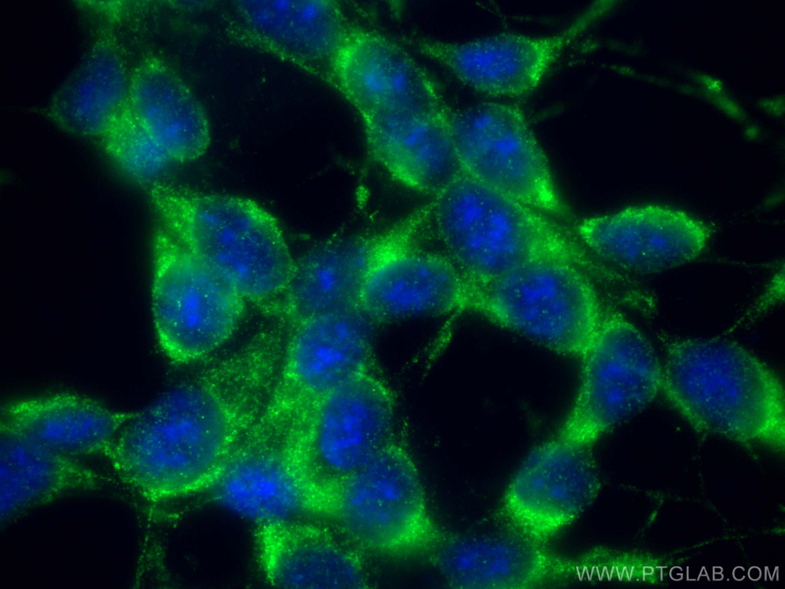 IF Staining of SH-SY5Y using 66140-1-Ig (same clone as 66140-1-PBS)