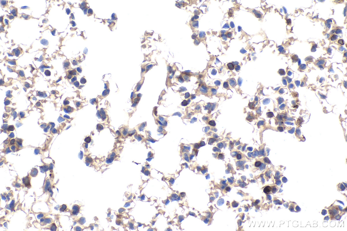 IHC staining of mouse lung using 67824-1-Ig