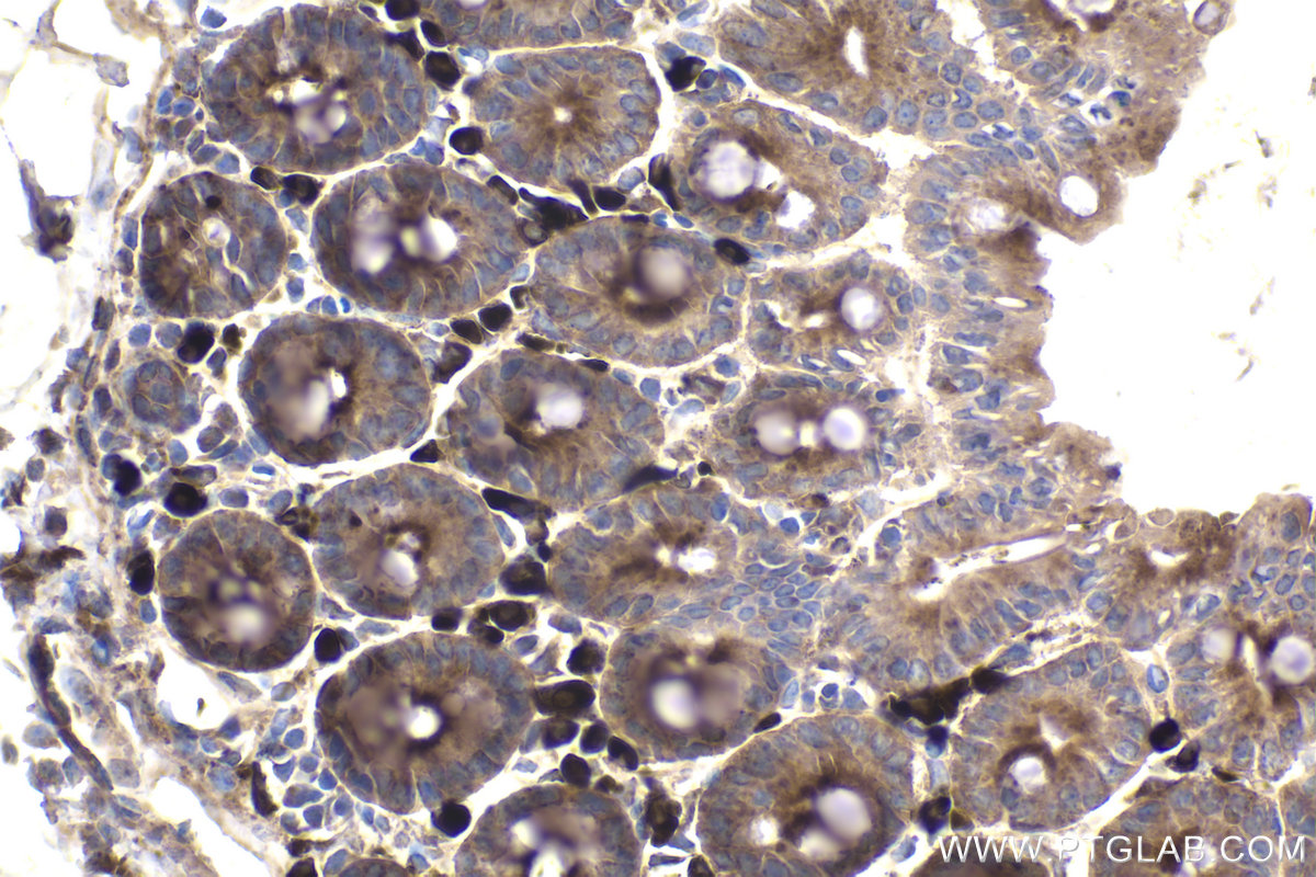 IHC staining of mouse intestine using 67824-1-Ig (same clone as 67824-1-PBS)