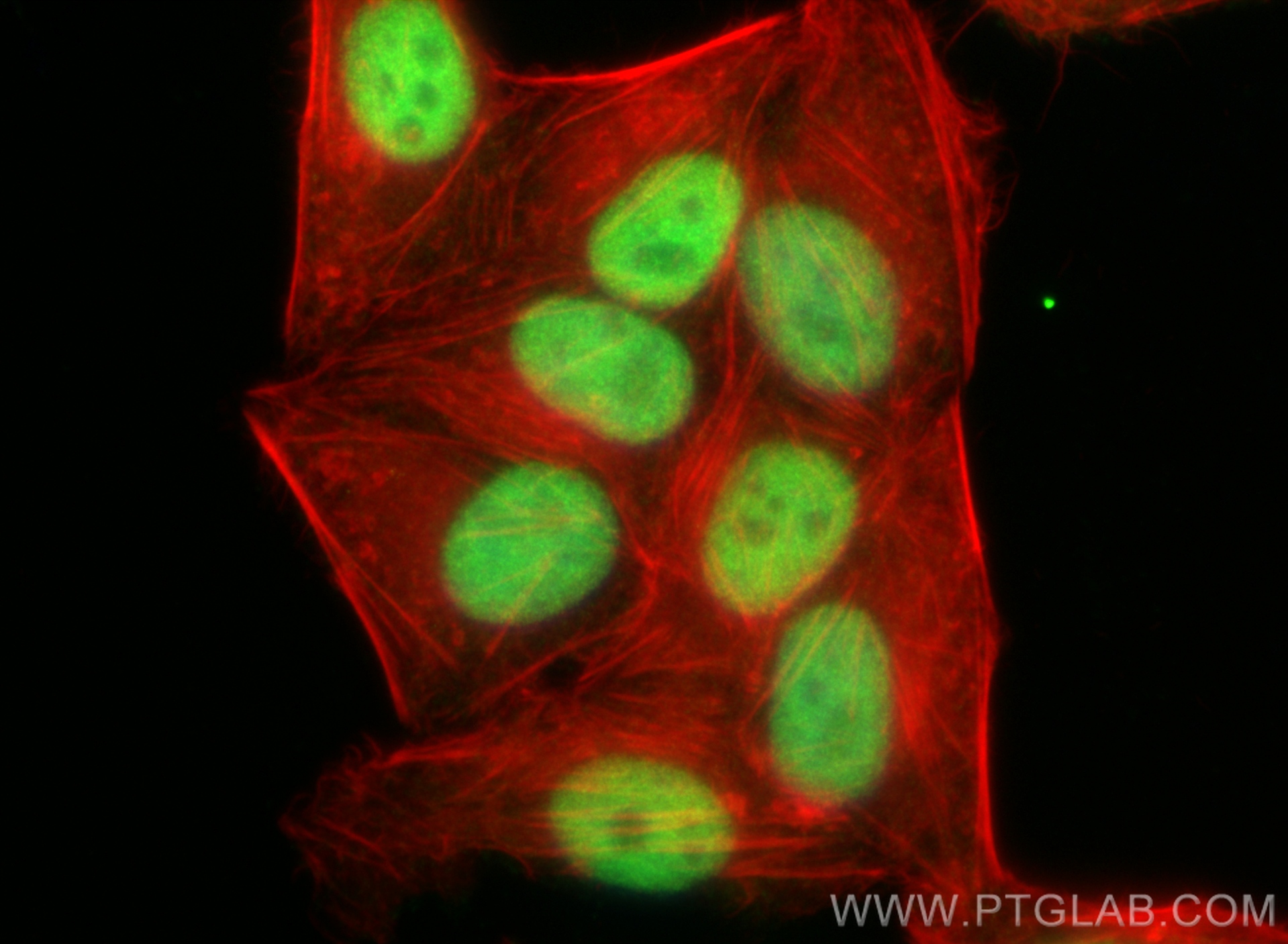 IF Staining of HepG2 using 14496-1-AP