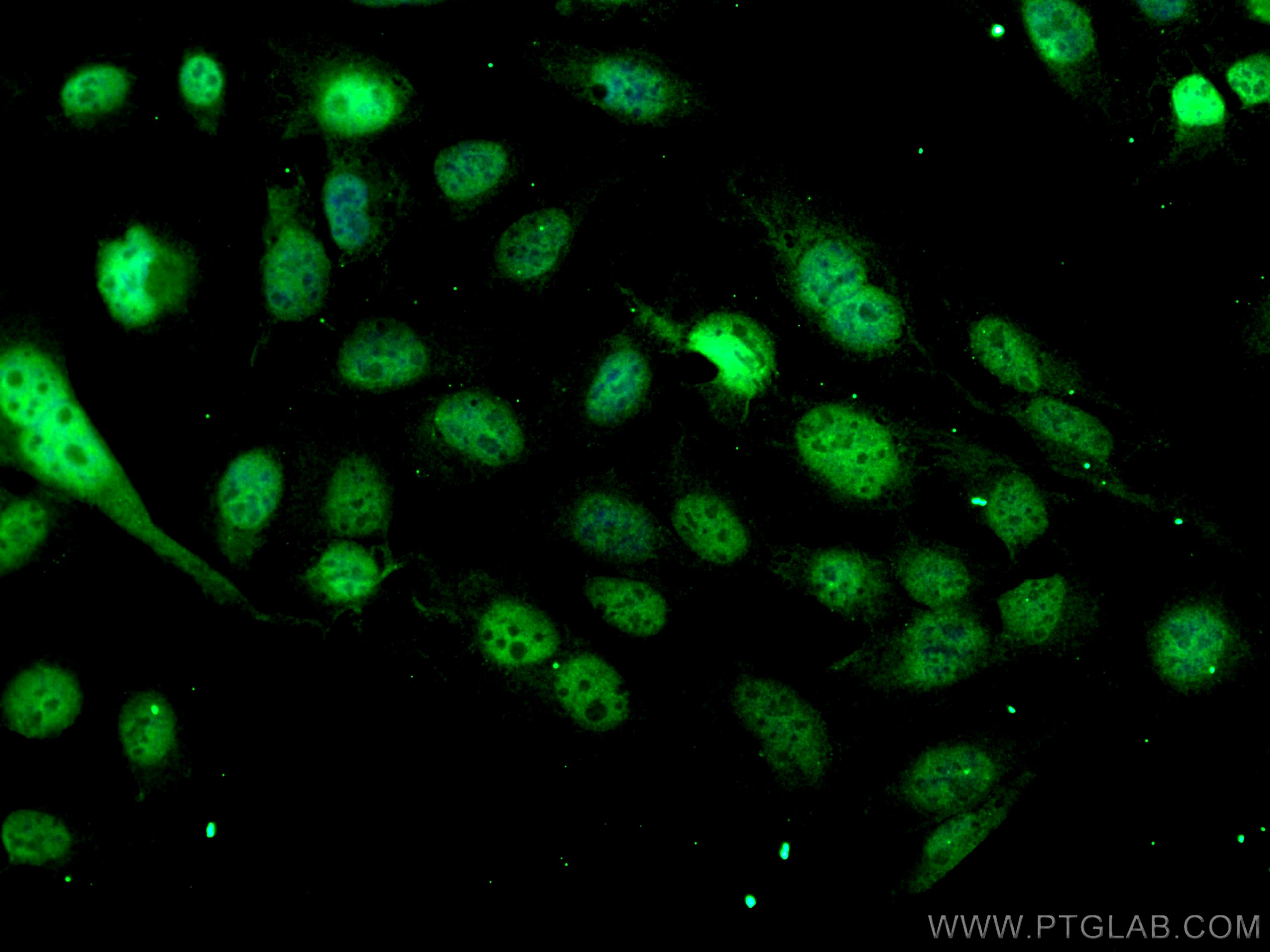 IF Staining of U2OS using 26127-1-AP