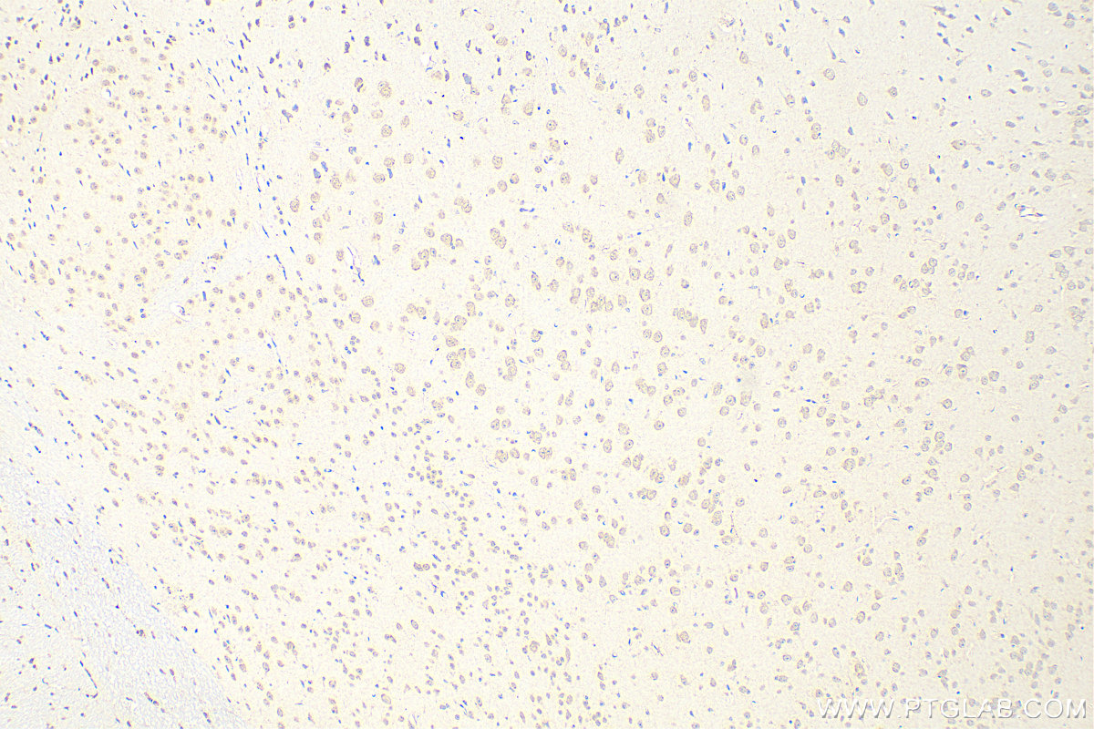 IHC staining of mouse brain using 26127-1-AP