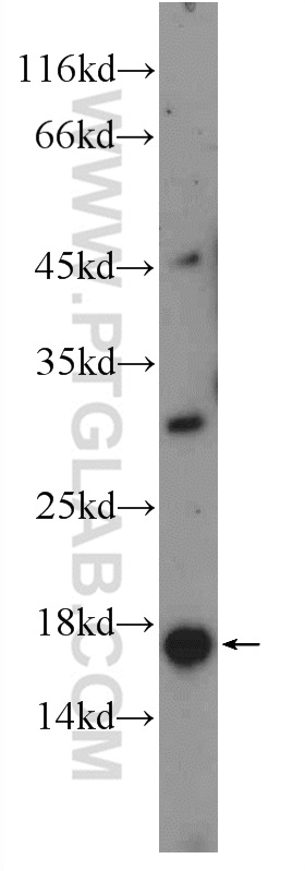 WB analysis of mouse testis using 26034-1-AP