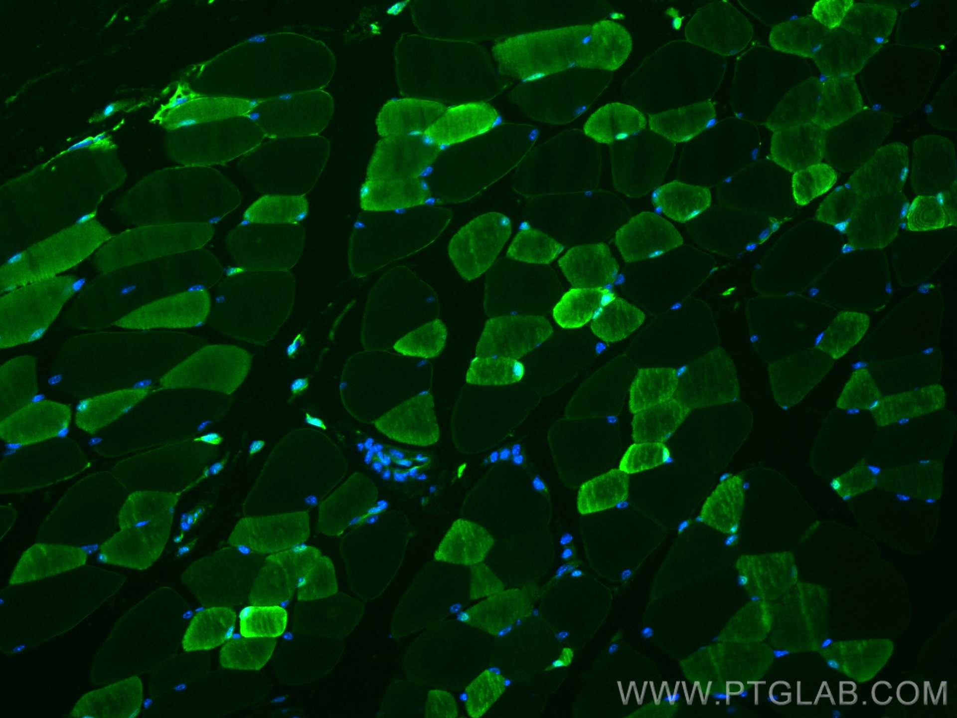 IF Staining of mouse skeletal muscle using CL488-15197