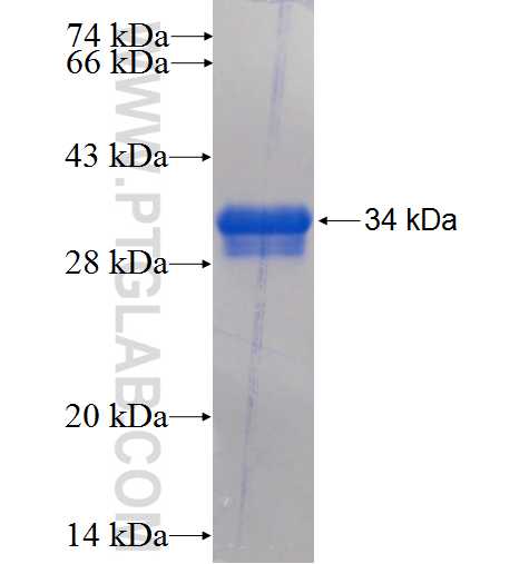 CA6 fusion protein Ag24207 SDS-PAGE