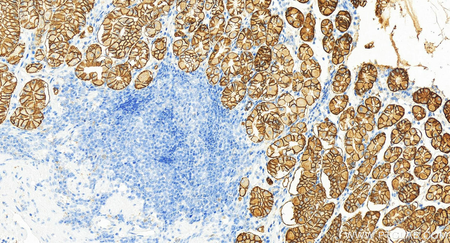 IHC staining of normal stomach using 11071-1-AP