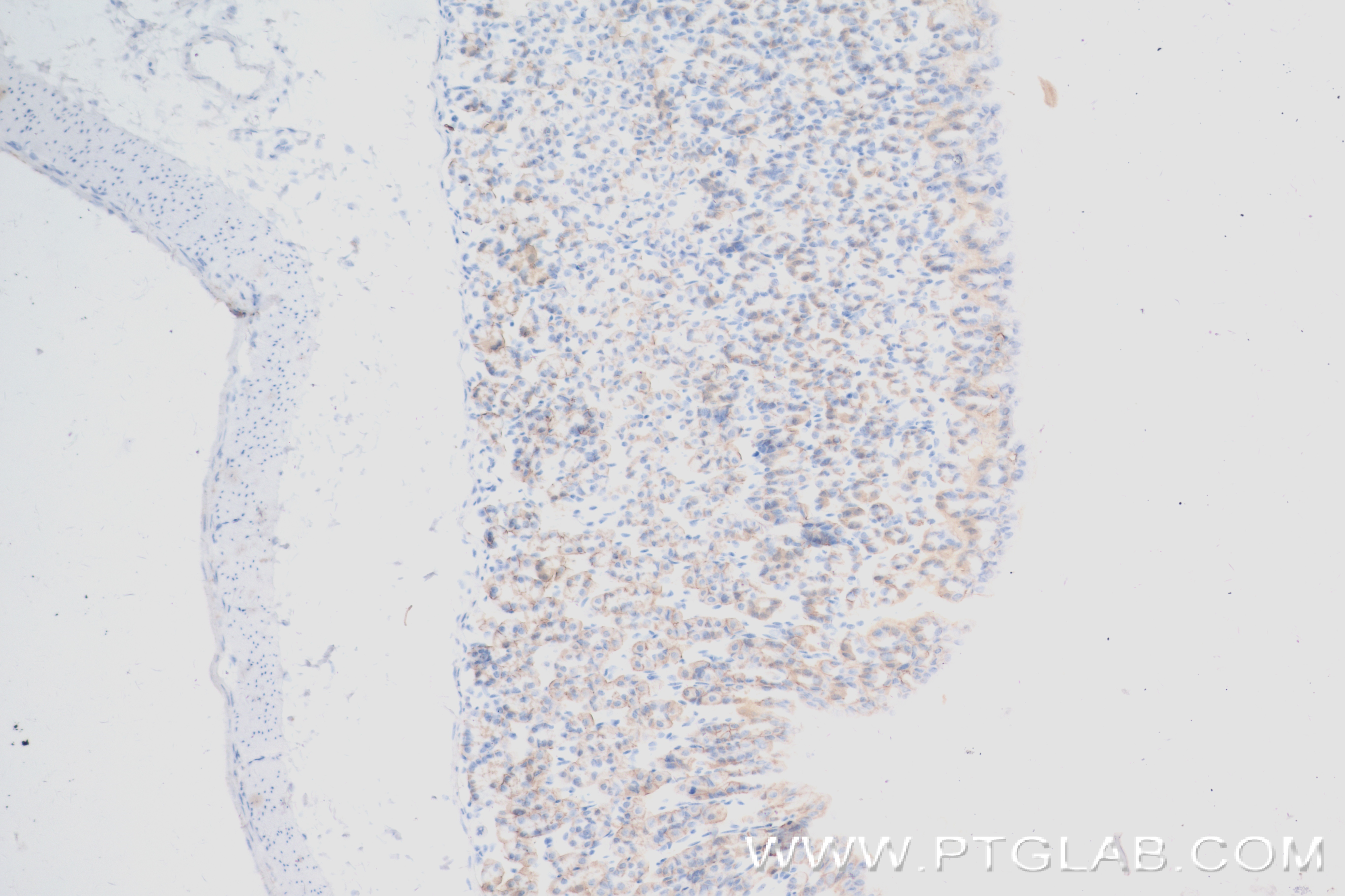 IHC staining of mouse stomach using 84233-1-RR