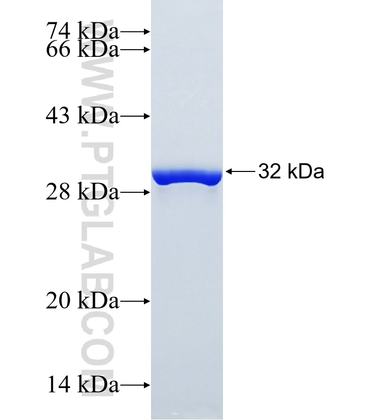 CAB39 fusion protein Ag36153 SDS-PAGE