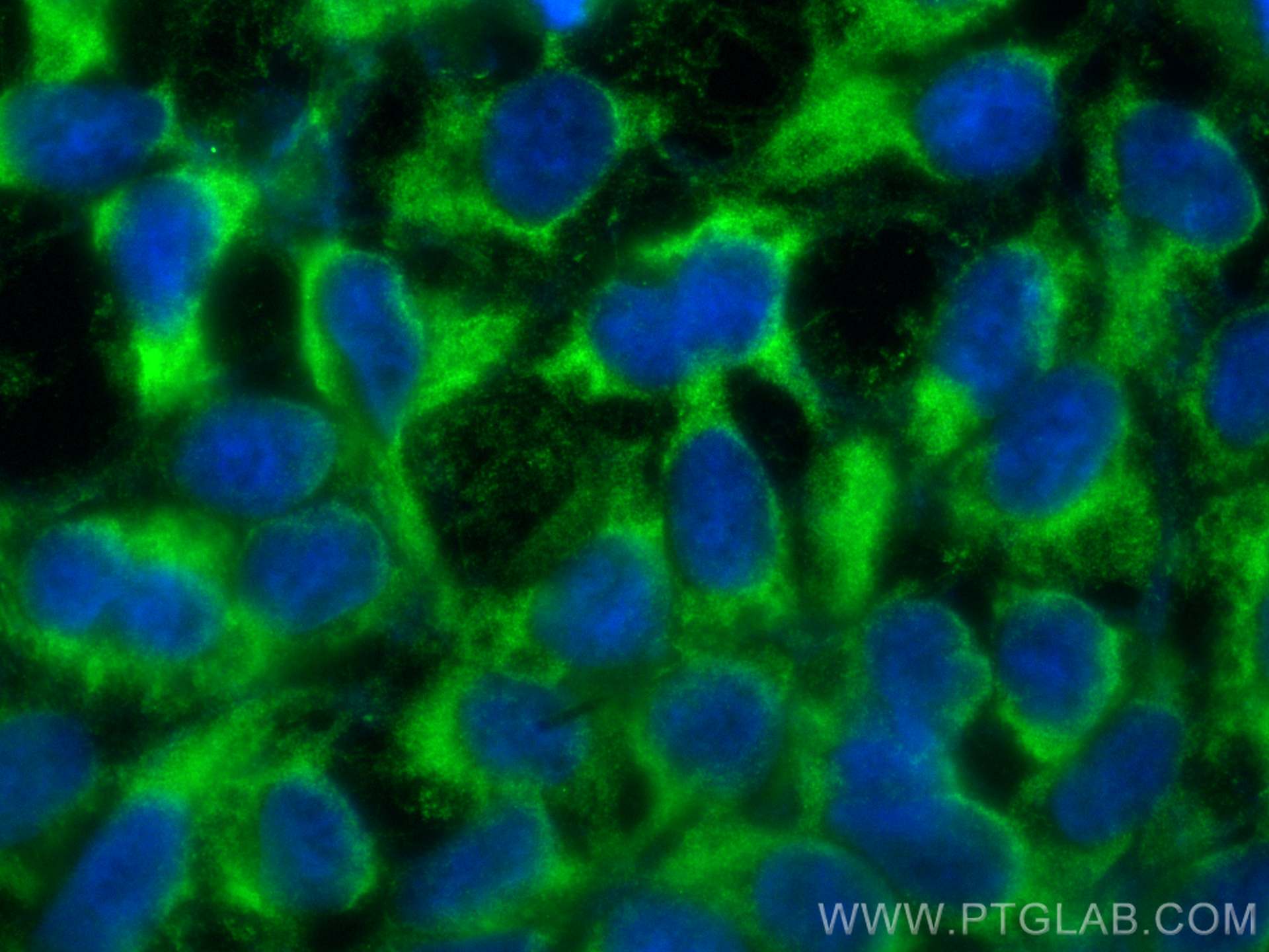 IF Staining of HEK-293 using 16137-1-AP