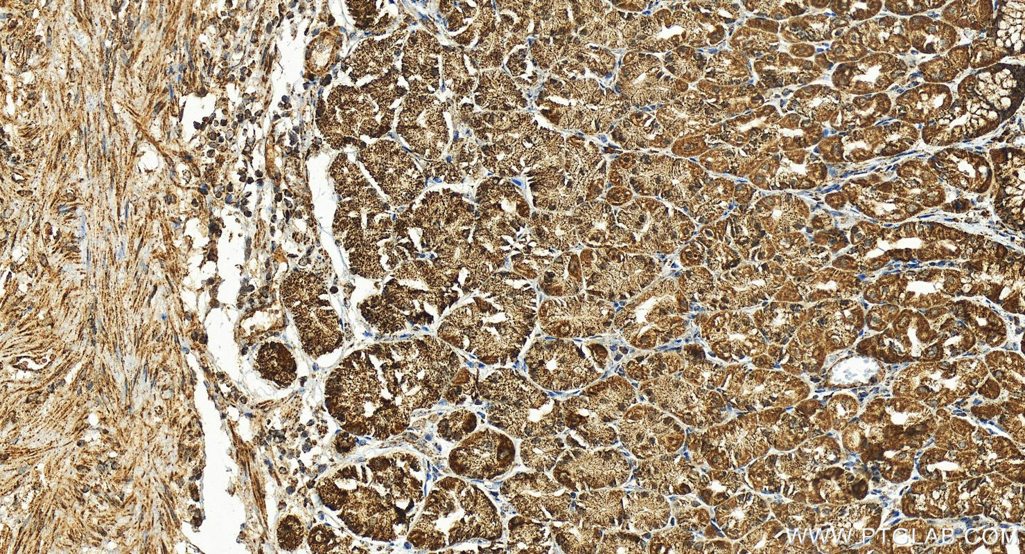 IHC staining of human stomach using 15528-1-AP