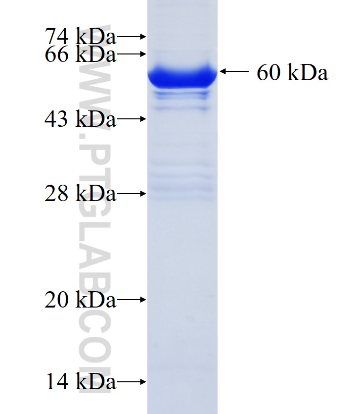 CACHD1 fusion protein Ag22138 SDS-PAGE