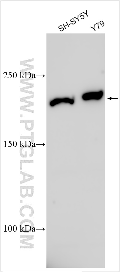 WB analysis using 30625-1-AP