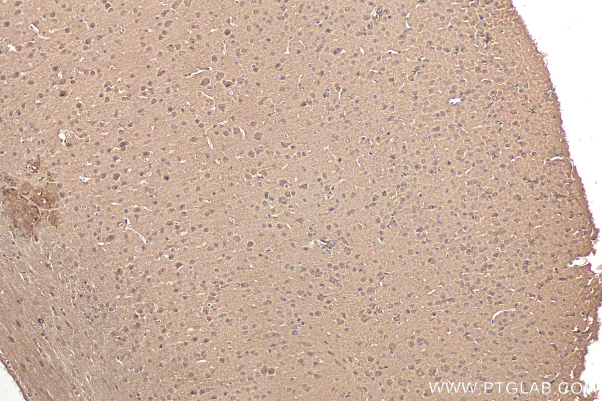 IHC staining of mouse brain using 68161-1-Ig